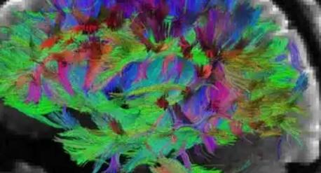 人体“司令部”如何组建 新研究绘制大脑早期发育遗传图谱