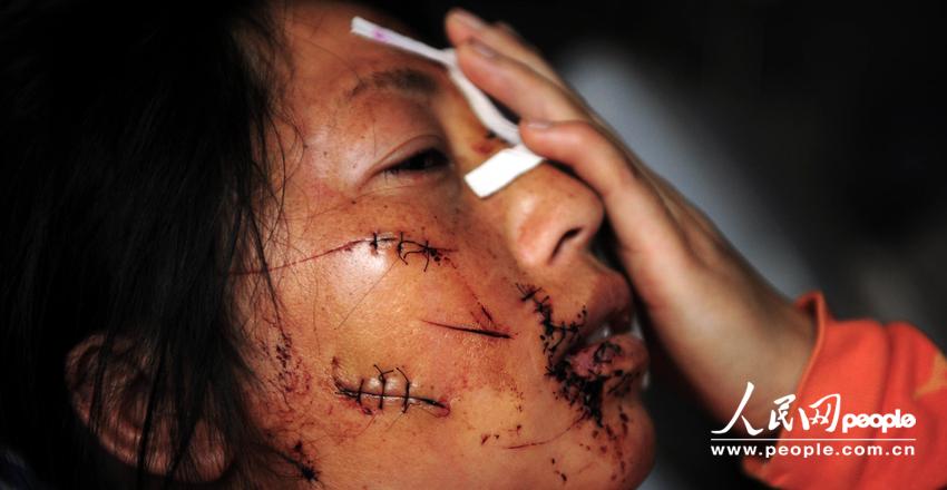 ������ͥ�����գ�����»������˵�ȭͷ��