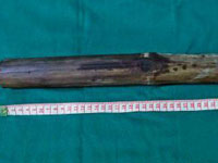 ����һ���Ӵ�5¥ˤ�����屻��ʹ̴���