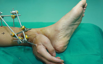 ����С��������� ҽ�������м������ס�