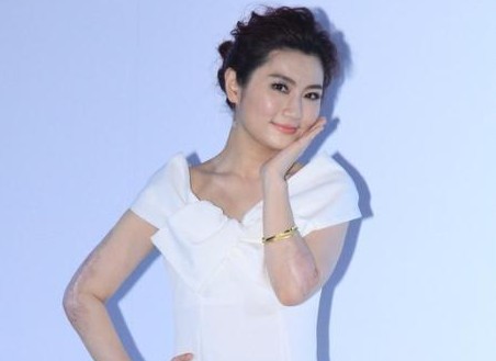 Selina出席活动疤痕明显”