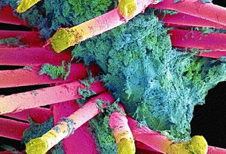 实拍电子显微镜下毛骨悚然的牙齿细菌”