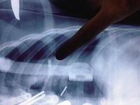 2���к�������ǹ��4����������������(ͼ)��