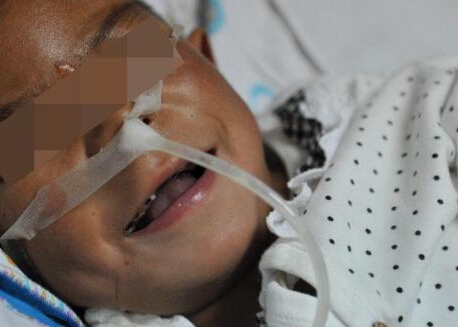 四川8岁7公斤重小女孩病情缓解”