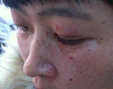 沈阳女公交司机遭暴打鼻骨骨折 打人男子被监控拍下(图)”