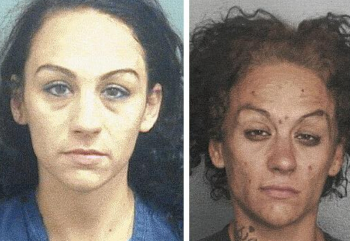 系列照揭示吸毒者面容巨变”