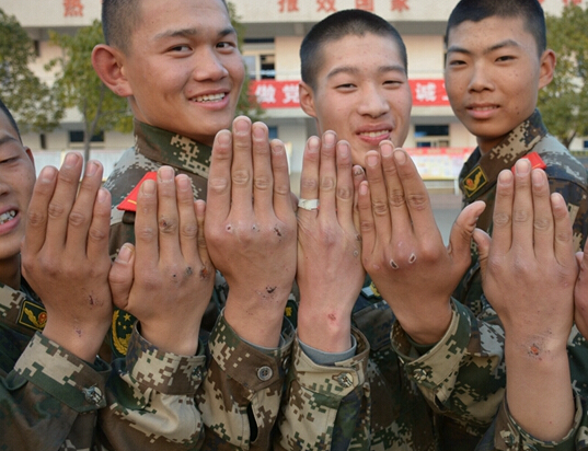 当兵人的手:伤疤铸成勋章”