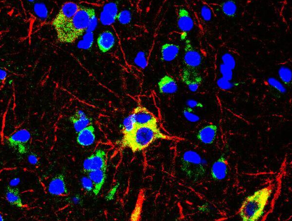 ��΢���Ŵ�һǧ����������ͼ��