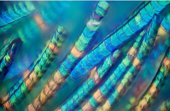 ΢�۾�ͷ�Ŀ�ȸ��ëѤ�ö�Ŀ��