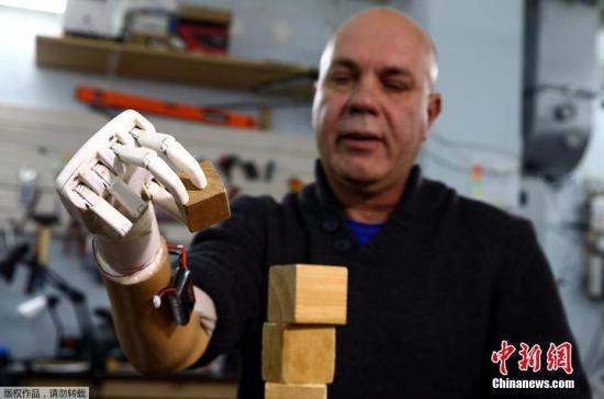 10��25����Ϣ���׶���˹��˹�ˣ��׶���˹��������ʦʹ��3D��ӡ����Ϊ�ϱ�20��ĸ�����������֫��20��ǰ����λ������Ϊһ���¹ʽ�֫�����װ����֫�ĸ�������ӵ��˫�֣��ͺ���һ����ߡ�