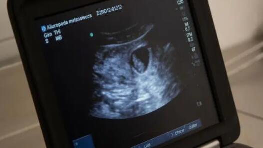 ��ְ��Ů�Խ������䡿����ӭ�Ӻá��С�������μ�����ѣ�