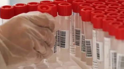 内蒙古新增78例本土确诊病例和8例本土无症状感染者