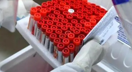 重庆新增1例本土无症状感染者 