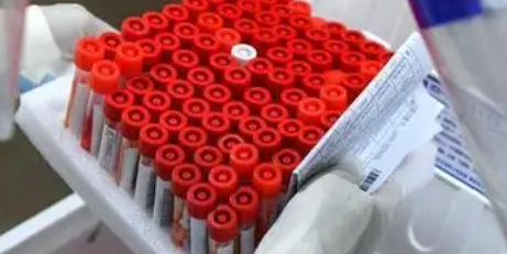 辽宁丹东发布新增7例本土无症状感染者详情