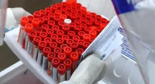 湖北武汉新增2例本土无症状感染者 详情公布