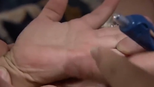 宝贝手心脚心冒小红疹？请看冬季手足口病防护指南